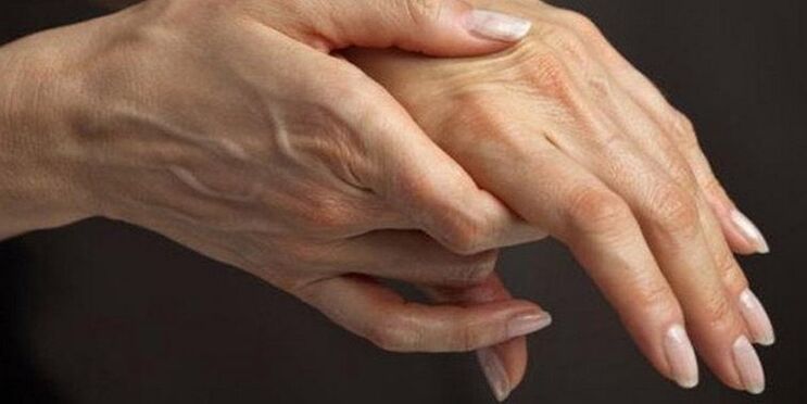 Bol u zglobovima prstiju: uzroci i liječenje, što učiniti ako zglobovi prstiju bole