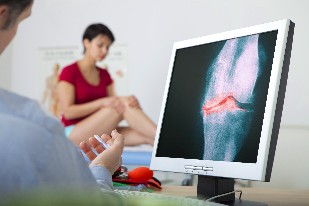 osteoartritis dijagnostika