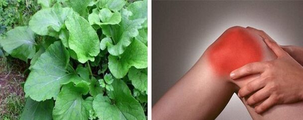 Prednosti čička za artrozu zgloba koljena