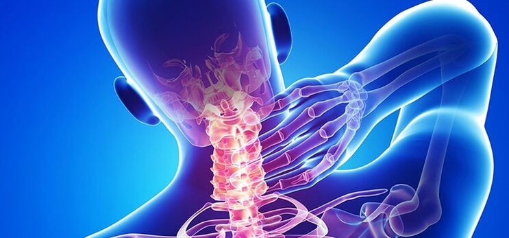 osteohondroza vratne kralježnice