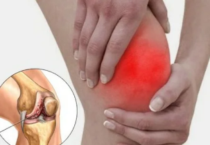 Što se događa kada artritisa